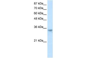 RNASEH2A antibody used at 1. (RNASEH2A anticorps  (Middle Region))