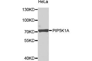 Western blot analysis of extracts of HeLa cells, using PIP5K1A antibody (ABIN5975757) at 1/1000 dilution. (PIP5K1A anticorps)
