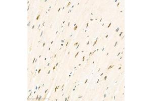 Immunohistochemistry analysis of paraffin embedded mouse heart using KCNIP3 (ABIN7073771) at dilution of 1: 2000 (DREAM anticorps)