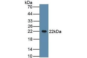 Detection of Recombinant CSN2, Bovine using Polyclonal Antibody to Casein Beta (CSN2) (CSN2 anticorps  (AA 16-224))