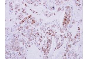 anti-Developmentally Regulated GTP Binding Protein 2 (DRG2) (AA 55-273) antibody