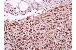 IHC-P Image Immunohistochemical analysis of paraffin-embedded ES2 xenograft, using ERCC2, antibody at 1:500 dilution.