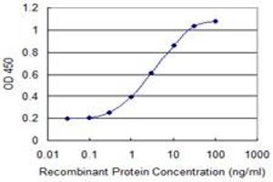 Detection limit for recombinant GST tagged MAP1S is 0.