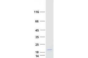 Validation with Western Blot