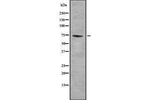 Western blot analysis of GTPBP4 using COLO205 whole  lysates. (GTPBP4 anticorps  (C-Term))