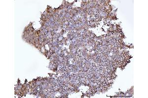 IHC analysis of SNAP23 using anti-SNAP23 antibody (ABIN7599089). (SNAP23 anticorps  (AA 1-211))