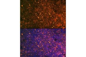 Immunofluorescence analysis of mouse spleen using CD38 Rabbit pAb (ABIN6130076, ABIN6138177, ABIN6138178 and ABIN6217677) at dilution of 1:100 (40x lens). (CD38 anticorps  (AA 46-300))
