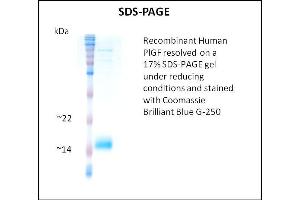 SDS-PAGE (SDS) image for Placenta Growth Factor (PGF) (Active) protein (ABIN5509580)