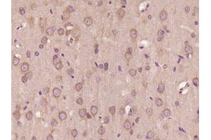 Paraformaldehyde-fixed, paraffin embedded Rat brain Antigen retrieval by boiling in sodium citrate buffer (pH6.