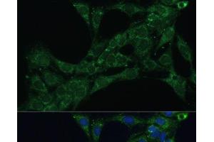 Immunofluorescence analysis of C6 cells using ETFB Polyclonal Antibody at dilution of 1:100 (40x lens).