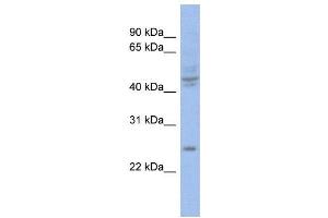 WB Suggested Anti-PROP1  Antibody Titration: 0. (PROP1 anticorps  (Middle Region))