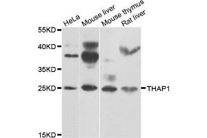 Western blot analysis of extracts of various cell lines, using THAP1 antibody (ABIN5975558) at 1/1000 dilution.
