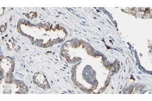 ABIN6268850 at 1/100 staining Human prostate tissue by IHC-P.