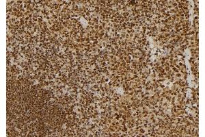 ABIN6257380 and ABIN6275314 at 1/100 staining Mouse spleen tissue by IHC-P. (NUMA1 anticorps  (N-Term))