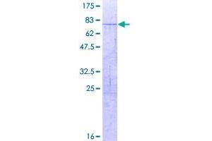 Image no. 1 for Nuclear Receptor Subfamily 2, Group F, Member 1 (NR2F1) (AA 1-423) protein (GST tag) (ABIN1312962)