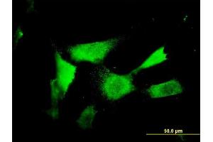 Immunofluorescence of monoclonal antibody to NAAA on NIH/3T3 cell.