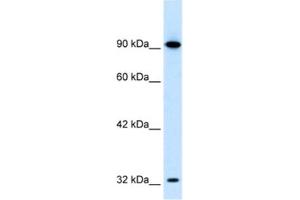 Western Blotting (WB) image for anti-SRY (Sex Determining Region Y)-Box 30 (SOX30) antibody (ABIN2460399)