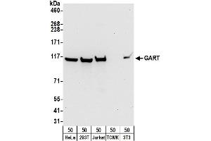 anti-Phosphoribosylglycinamide Formyltransferase (GART) (AA 960-1010) antibody