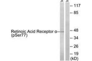 Western blot analysis of extracts from Jurkat cells treated with PMA 125ng/ml 30' and Jurkat cells treated with insulin 0. (Retinoic Acid Receptor alpha anticorps  (pSer77))
