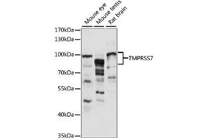 Western blot analysis of extracts of various cell lines, using TMPRSS7 antibody (ABIN7270949) at 1:1000 dilution. (TMPRSS7 anticorps  (AA 478-717))