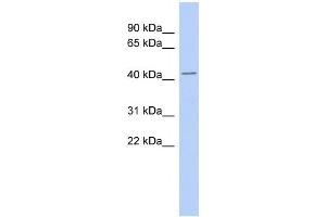 WB Suggested Anti-TMPO Antibody Titration:  0. (Thymopoietin anticorps  (Middle Region))