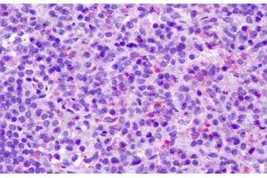 Anti-CCR7 antibody IHC staining of human spleen.