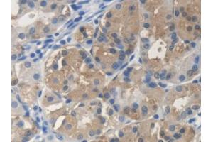 DAB staining on IHC-P; Samples: Human Stomach Tissue (SCARA5 anticorps  (AA 118-495))