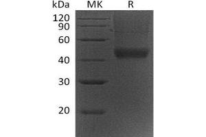 Western Blotting (WB) image for Decorin (DCN) protein (His tag) (ABIN7320511)