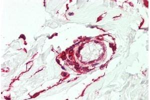 Human Vessel: Formalin-Fixed, Paraffin-Embedded (FFPE)