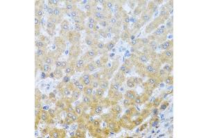 Immunohistochemistry of paraffin-embedded human liver using IL20 antibody (ABIN6128133, ABIN6142353, ABIN6142354 and ABIN6222322) at dilution of 1:100 (40x lens). (IL-20 anticorps  (AA 25-176))