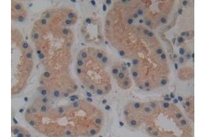 Detection of GAD2 in Human Kidney Tissue using Polyclonal Antibody to Glutamate Decarboxylase 2 (GAD2)