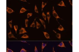 Immunofluorescence analysis of L929 cells using GPR22 Polyclonal Antibody at dilution of 1:100.