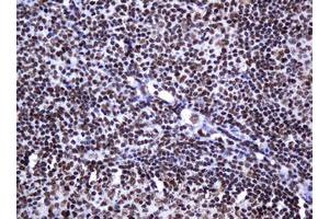 Image no. 3 for anti-Decapping Enzyme, Scavenger (DCPS) antibody (ABIN1497781)