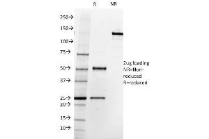 SDS-PAGE Analysis Purified FOLH1 (PSMA) Mouse Monoclonal Antibody (SPM500). (PSMA anticorps  (AA 232-433))