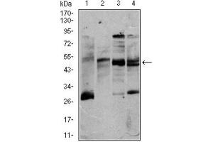 Western Blotting (WB) image for anti-CD5 (CD5) (AA 27-233) antibody (ABIN1845336) (CD5 anticorps  (AA 27-233))