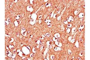 Immunohistochemistry of paraffin-embedded human brain tissue using ABIN7150398 at dilution of 1:100 (IGHMBP2 anticorps  (AA 646-884))