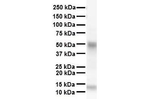 WB Suggested Anti-SMAD6 antibody Titration: 1 ug/mL Sample Type: Human heart (SMAD6 anticorps  (N-Term))