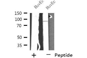 Western blot analysis of extracts from HuvEc cells, using SH3RF3 antibody. (SH3RF3 anticorps  (C-Term))