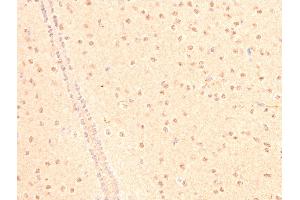 ABIN6267066 at 1/200 staining mouse brain tissue sections by IHC-P.