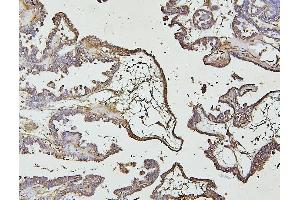 IHC analysis of IRAK1 using anti-IRAK1 antibody (ABIN7603128).