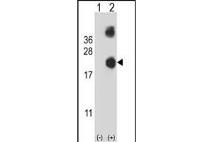 Western blot analysis of DSTN (arrow) using rabbit polyclonal DSTN Antibody (Center) (ABIN653136 and ABIN2842712). (Destrin anticorps  (AA 70-98))