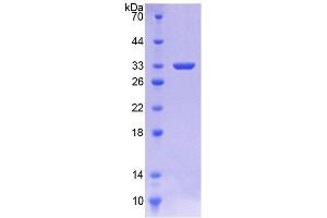 SDS-PAGE (SDS) image for Serpin Family C Member 1 (SERPINC1) (AA 1-259) protein (His tag) (ABIN4989156)