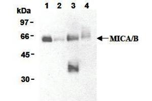Western Blotting (WB) image for anti-MHC Class I Polypeptide-Related Sequence A (MICA) antibody (ABIN1108244) (MICA anticorps)