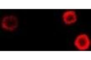 Immunofluorescent analysis of Epsilon-sarcoglycan staining in Hela cells. (SGCE anticorps)