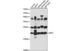 Western blot analysis of extracts of various cell lines, using BTF3 antibody (ABIN6290109) at 1:1000 dilution.