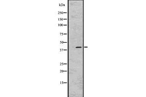 Western blot analysis of GPR45 expression in RPMI-8226 whole cell lysate ;,The lane on the left is treated with the antigen-specific peptide. (GPR45 anticorps  (Internal Region))