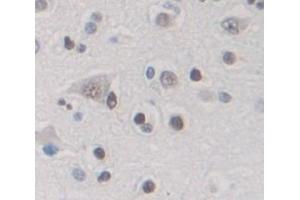 IHC-P analysis of Human Tissue, with DAB staining. (DYRK1A anticorps  (AA 16-300))