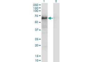 Western Blot analysis of YAP1 expression in transfected 293T cell line by YAP1 monoclonal antibody (M01), clone 2F12. (YAP1 anticorps  (AA 53-161))