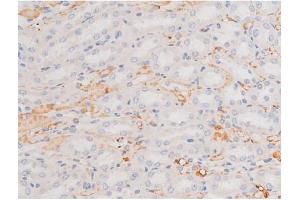 ABIN6267364 at 1/200 staining Rat kidney tissue sections by IHC-P. (KIT anticorps  (pTyr703))