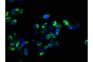 Immunofluorescence staining of Hela cells with ABIN7158282 at 1:100, counter-stained with DAPI.